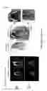 Fig. 06 - METHOD FOR PRODUCING A PLURALITY OF TEETH FROM ONE ISOLATED TOOTH GERM