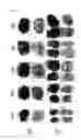 Fig. 07 - METHOD FOR PRODUCING A PLURALITY OF TEETH FROM ONE ISOLATED TOOTH GERM