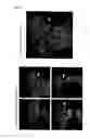 Fig. 08 - METHOD FOR PRODUCING A PLURALITY OF TEETH FROM ONE ISOLATED TOOTH GERM