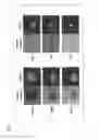 Fig. 02 - Method of constructing masses of myocardial cells and use of the myocardial cell mass