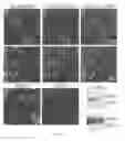 Fig. 06 - TREATMENT OF DISORDERS WITH ALTERED VASCULAR BARRIER FUNCTION