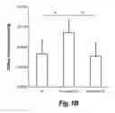Fig. 03 - Glaucoma treatment