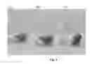 Fig. 02 - Thermosensitive injectable hydrogel for drug delivery
