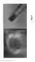 Fig. 06 - Thermosensitive injectable hydrogel for drug delivery