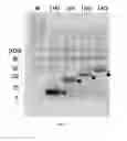 Fig. 06 - Multimeric antimicrobial peptide complex which is displayed on cell surface