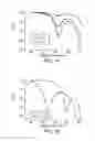 Fig. 13 - Magnetic microstructures for magnetic resonance imaging