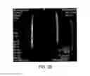 Fig. 24 - Magnetic microstructures for magnetic resonance imaging