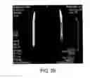 Fig. 25 - Magnetic microstructures for magnetic resonance imaging