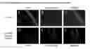 Fig. 02 - COMPOSITIONS AND METHODS OF DIAGNOSING OCULAR DISEASES