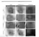 Fig. 04 - COMPOSITIONS AND METHODS OF DIAGNOSING OCULAR DISEASES