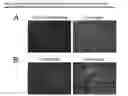 Fig. 06 - COMPOSITIONS AND METHODS OF DIAGNOSING OCULAR DISEASES