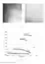 Fig. 02 - Nanofibrillar polysaccharide for use in the control and prevention of contraction and scarring