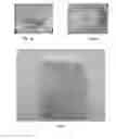 Fig. 02 - Injectable in situ polymerizable collagen composition