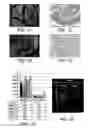 Fig. 02 - Injectable peripheral nerve specific hydrogel