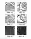 Fig. 08 - Injectable peripheral nerve specific hydrogel