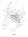 Fig. 07 - Controller and power source for implantable blood pump