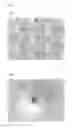 Fig. 06 - Nebulizer mesh and production method thereof