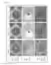 Fig. 08 - Nebulizer mesh and production method thereof