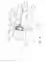 Fig. 08 - Securement device having an integral strap and dressing