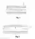 Fig. 02 - Balloon catheter with adjustable inner member