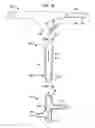 Fig. 22 - Systems and methods for shunting fluid