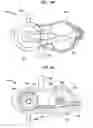 Fig. 33 - Systems and methods for shunting fluid