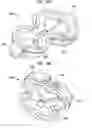 Fig. 35 - Systems and methods for shunting fluid