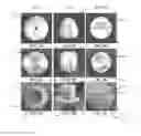 Fig. 04 - Ostomy pump system and related methods of use and manufacture