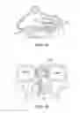 Fig. 13 - Methods and systems for toxin delivery to the nasal cavity