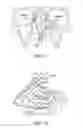 Fig. 14 - Methods and systems for toxin delivery to the nasal cavity