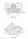 Fig. 16 - Methods and systems for toxin delivery to the nasal cavity