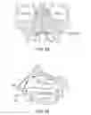 Fig. 17 - Methods and systems for toxin delivery to the nasal cavity