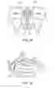 Fig. 18 - Methods and systems for toxin delivery to the nasal cavity