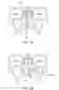Fig. 19 - Methods and systems for toxin delivery to the nasal cavity