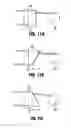 Fig. 07 - Extractor for removing a lead from a patient