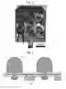 Fig. 03 - High-functionality bioelectrode