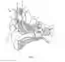 Fig. 02 - Implantable auditory prosthesis having isolated components