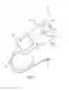 Fig. 03 - Implantable auditory prosthesis having isolated components