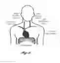 Fig. 03 - Transvascular diaphragm pacing systems and methods of use