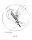 Fig. 05 - System and methods for multi-site activation of the thalamus