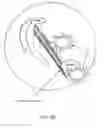Fig. 10 - System and methods for multi-site activation of the thalamus