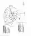 Fig. 14 - System and methods for multi-site activation of the thalamus