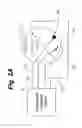 Fig. 03 - Coordinated medium voltage therapy for improving effectiveness of defibrillation therapy