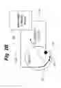 Fig. 04 - Coordinated medium voltage therapy for improving effectiveness of defibrillation therapy