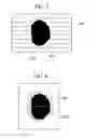 Fig. 04 - THERAPY PLANNING DEVICE, SYSTEM FOR PLANNED THERAPY, METHOD FOR MAKING THERAPY PLAN, AND PROGRAM