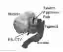 Fig. 01 - ADVANCED ROTATING-SHIELD BRACHYTHERAPY AND PLANNING OF THE SAME
