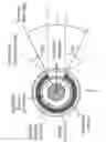 Fig. 46 - ADVANCED ROTATING-SHIELD BRACHYTHERAPY AND PLANNING OF THE SAME