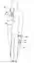 Fig. 13 - Exercise device for utilizing an elastic band to perform exercises