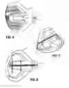 Fig. 06 - Golf club head with polymeric insert