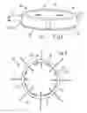Fig. 02 - Filter apparatus for a liquid vessel, in particular for aqueous urea solution